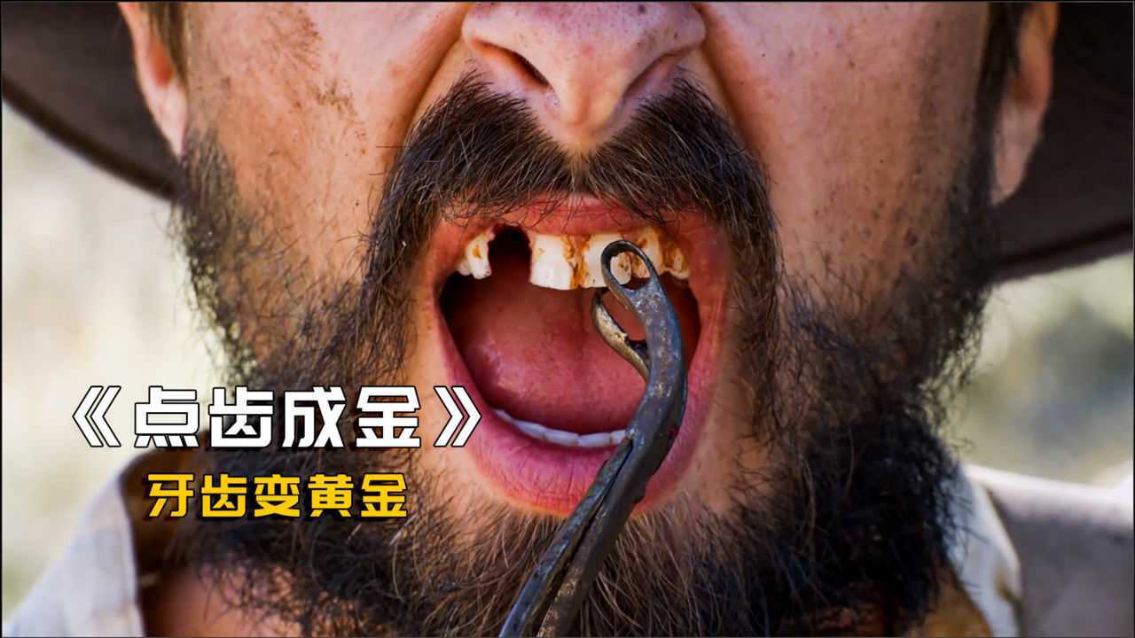 掉落的牙齿能变黄金男人为了黄金直接拔掉了一口牙点齿成金