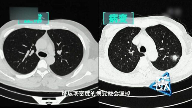 出题人匠心选题,15位主任医师共同挑战人工智能,共同诊断30张胸部CT片!【机智过人】