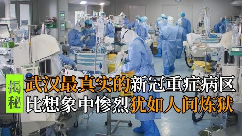 你见过武汉疫情的重症病房吗？一部冒死拍摄的纪录片带你见证惨状 纪录片