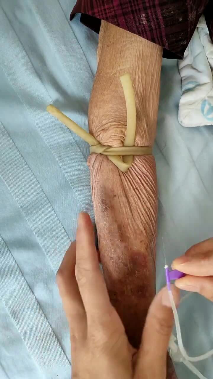 扎针,静脉输液_腾讯视频