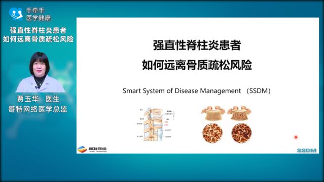强直性脊柱炎患者如何远离骨质疏松风险——贾玉华