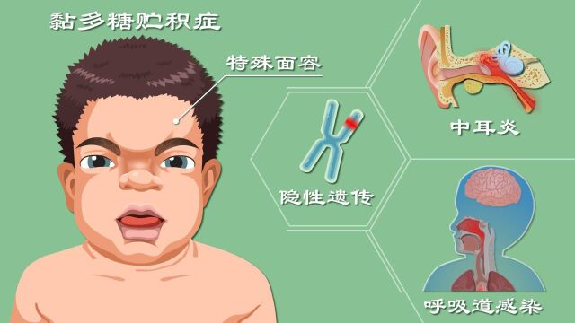 反复中耳炎、呼吸道感染?年花费百万?罕见病黏多糖贮积症动漫科普