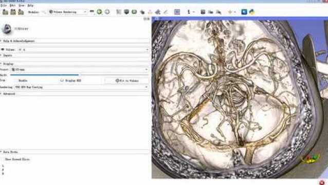 3DSlicer影像重建教程VR使用