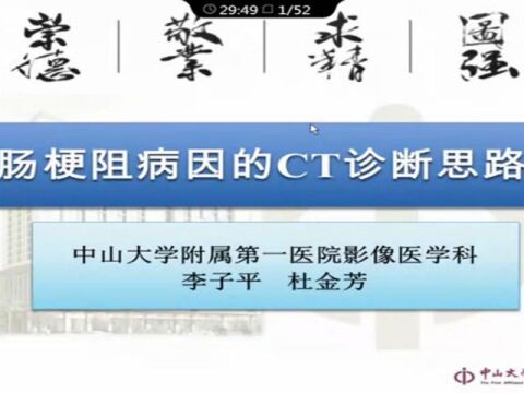 肠梗阻病因的CT诊断思路中山大学附属第一医院李子平