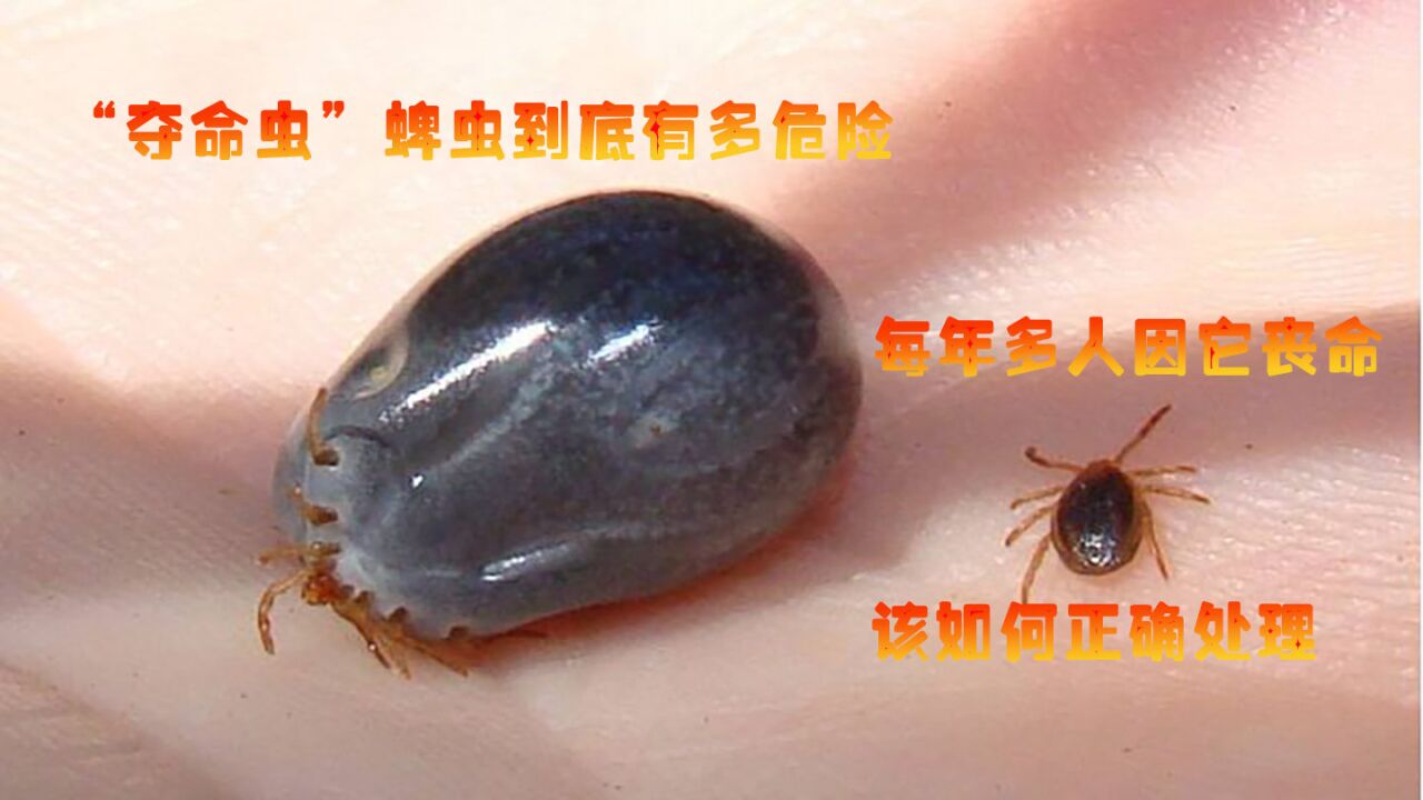 "夺命虫"蜱虫到底有多危险?每年多人因它丧命,该如何正确处理
