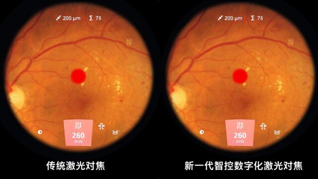 蔡司新一代智控数字激光