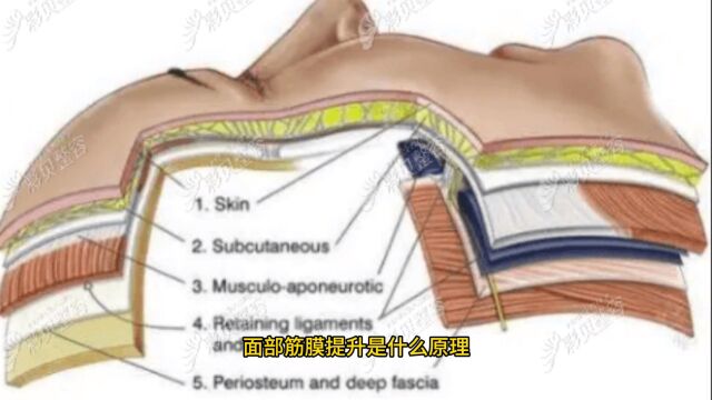 面部筋膜提升是什么原理、能保持多久秒懂~