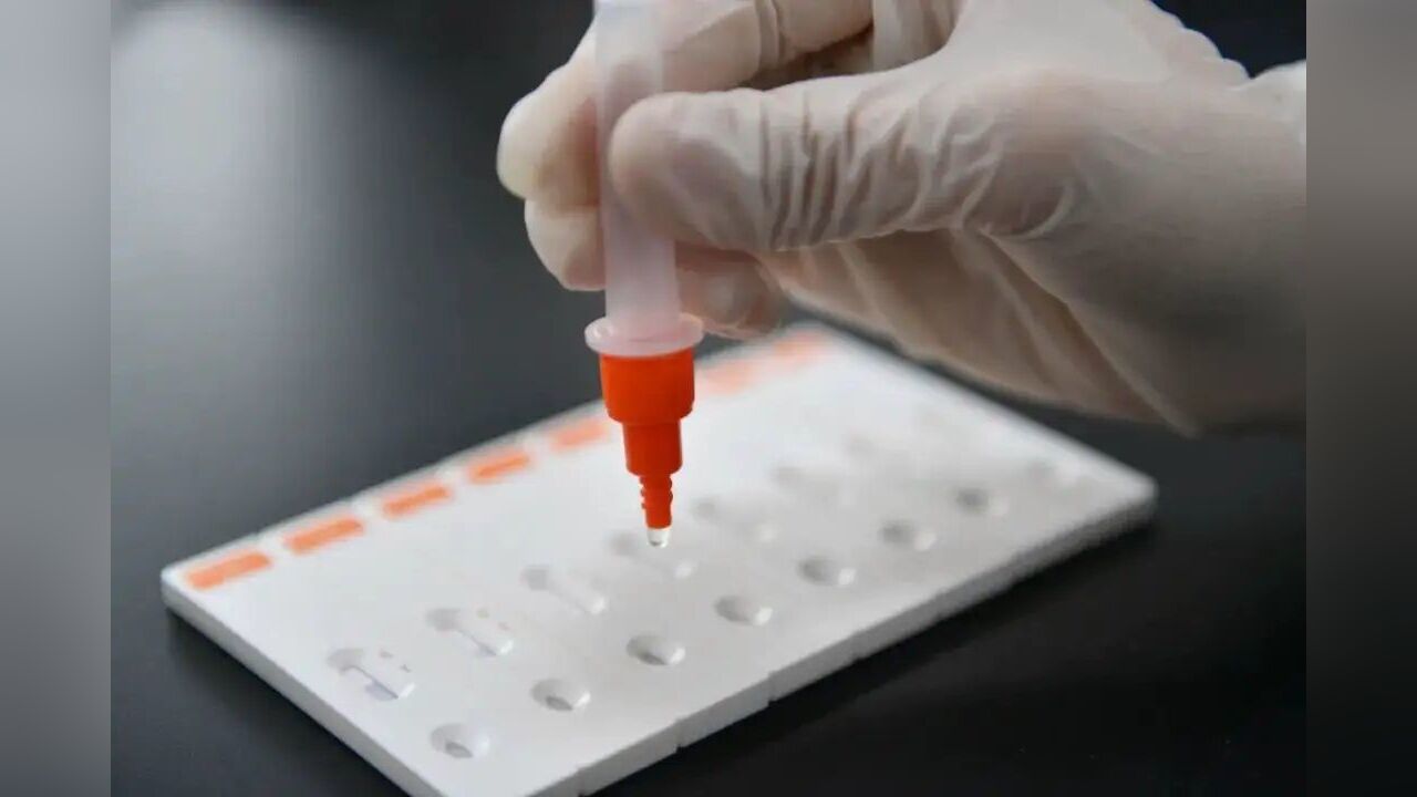 湖南疾控:2月7日起开展新冠病毒抗体检测服务