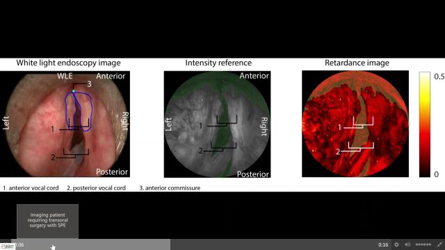 Surgical polarimetric endoscopy 