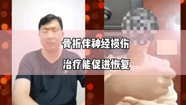 小荷视频咨询:骨折合并桡神经损伤,治疗能促进神经恢复.#医学科普 #小荷健康 #骨折 #骨科郭前进医生