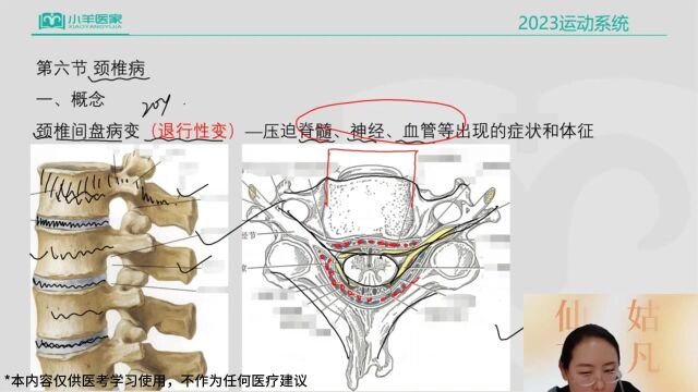 2023年医家医考最新临床课程 孙荣老师主讲小视频——颈椎病