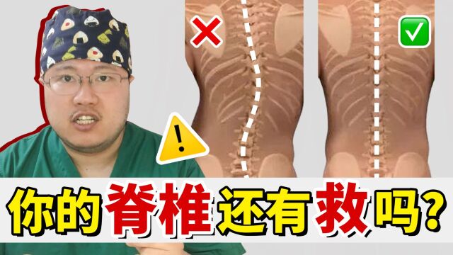 你正在毁掉你的脊柱!脊柱侧弯有多恐怖?这2个动作科学锻炼脊椎!