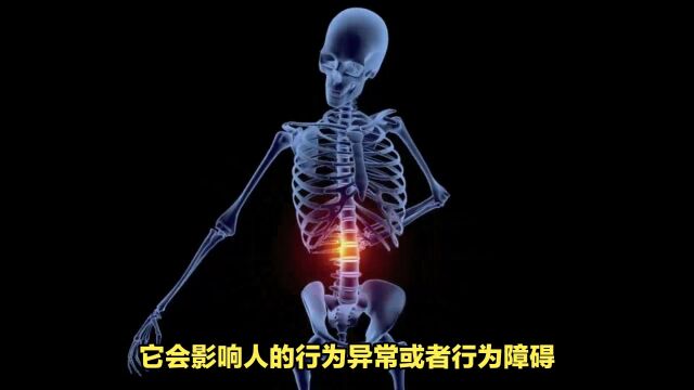 神经系统紊乱影响行为障碍