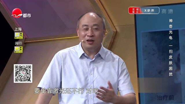 色素斑点怎么区分和治疗呢?