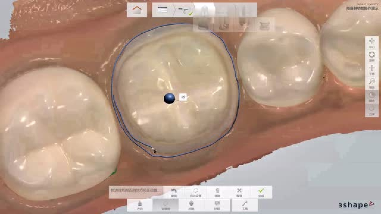 3shape口内扫描仪_高清1080P在线观看平台_腾讯视频