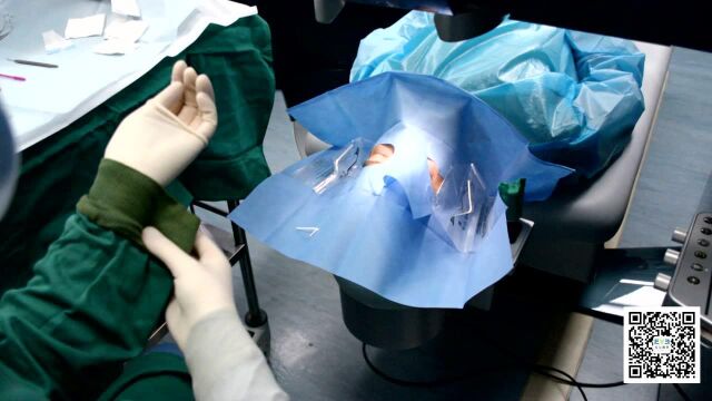 飞秒激光近视手术全过程