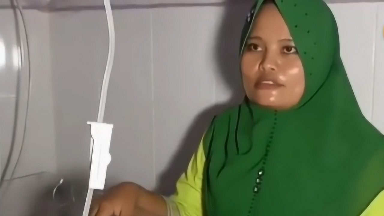 印尼女子生下无鼻独眼婴儿 或因怀孕期间接触了水银