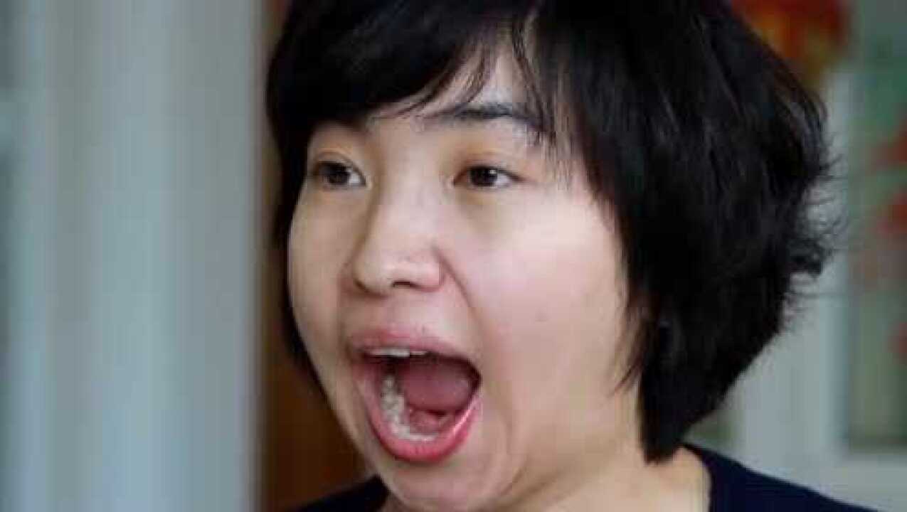 口部肌肉运动治疗之唇舌操_高清1080P在线观看平台_腾讯视频