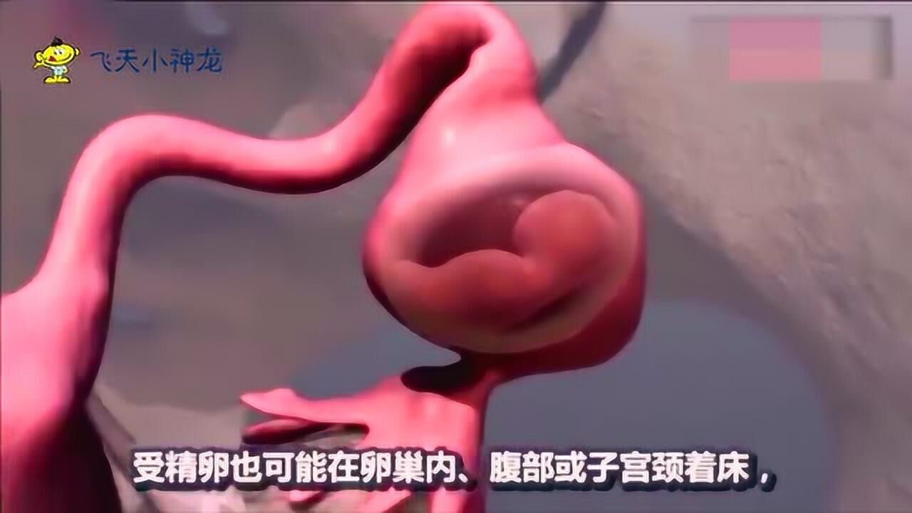 宫外孕是怎样形成的？三维动画直观演示，宝妈们快学习起来！_高清