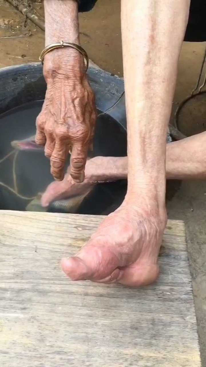 现在还有人在裹脚三寸金莲的4个指头是软的不裹就会特别疼