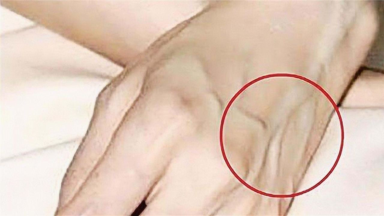 手上青筋凸起，暗示身体出现什么问题？专家的回答颠覆想象！