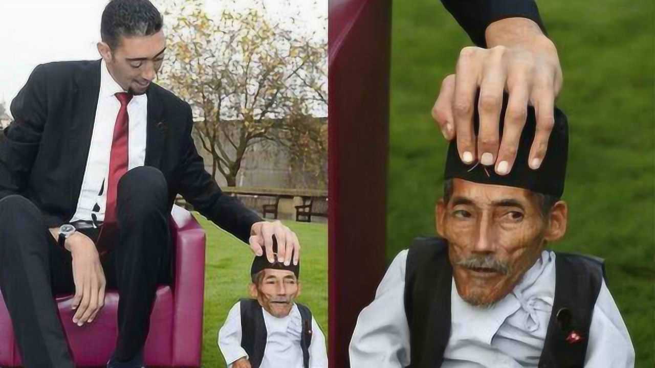 男人比女人更易患侏儒症?你知道身高多少才算是侏儒人_腾讯视频