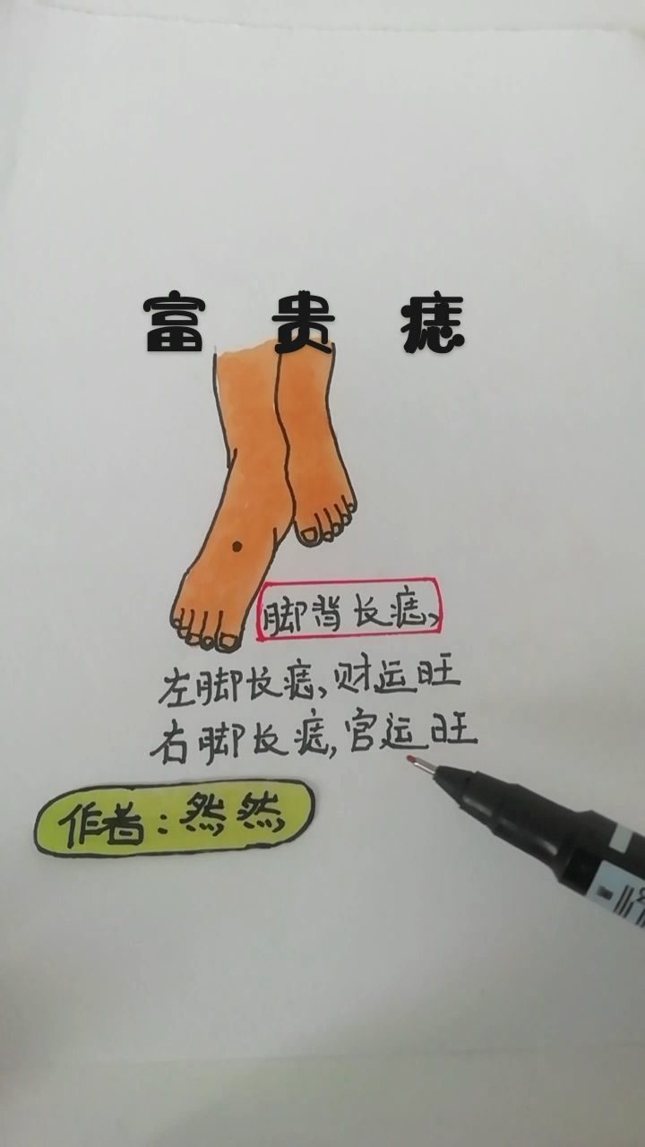 脱鞋看看你的脚背有痣吗