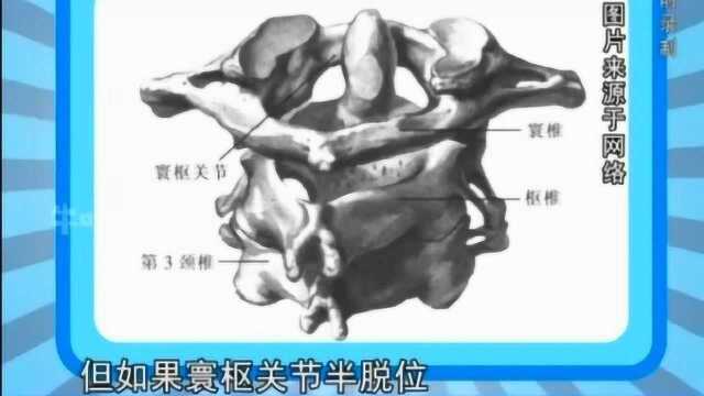 什么是寰枢关节脱位,对我们身体有什么样的影响?