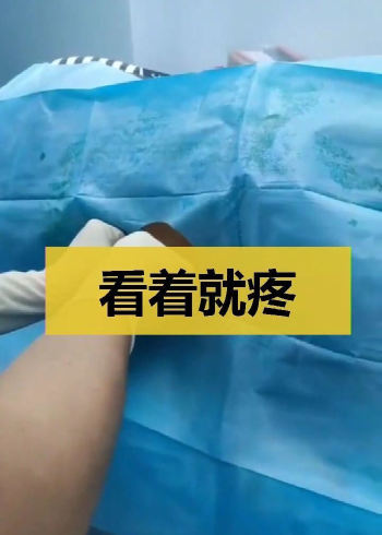 实拍女子分娩全过程,看着就疼,过程不要太恐怖