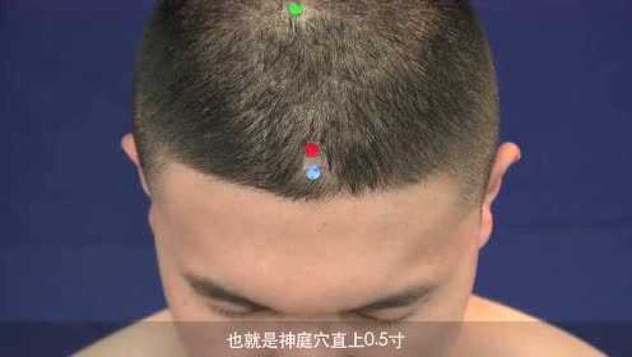 上星穴:降浊升清,熄风清热,宁神通鼻_高清1080P在线观看平台_腾讯视频