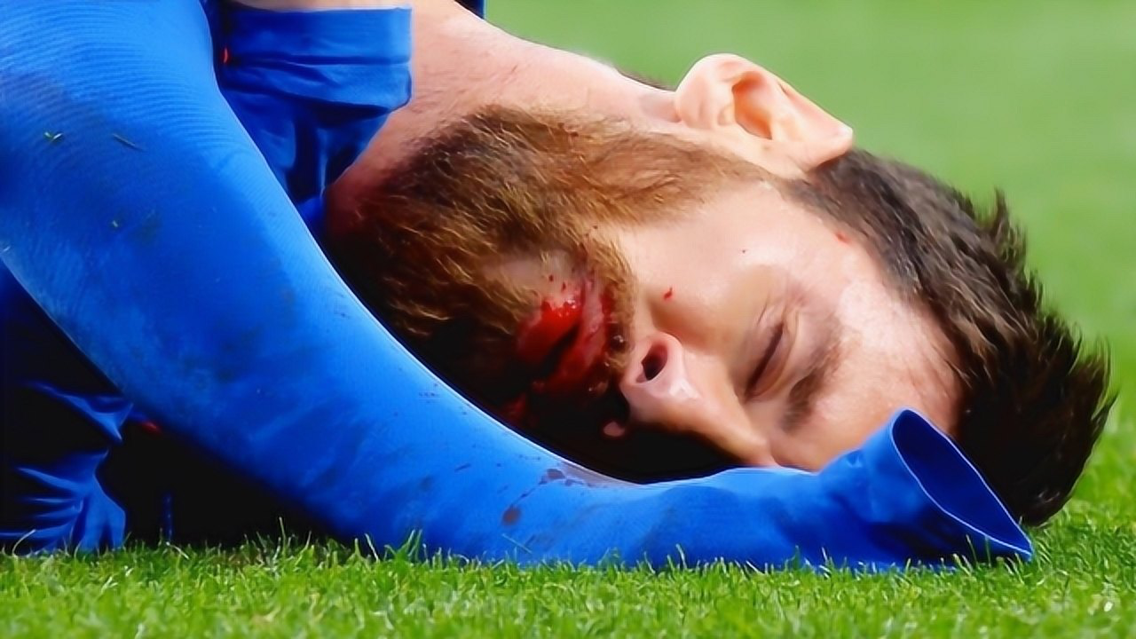 不忍直视!足球中的野蛮犯规与血染赛场 看完真是心疼这些球员