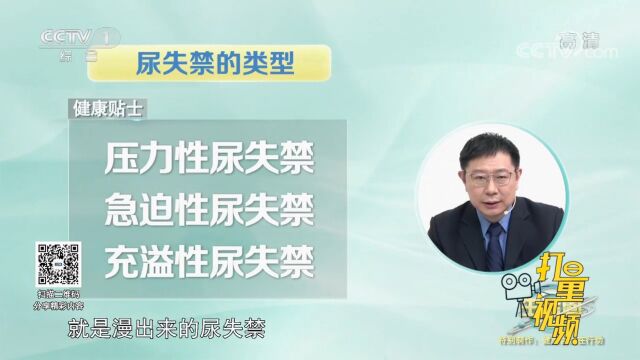 尿失禁有哪些类型?压力性尿失禁、急迫性尿失禁和充溢性尿失禁