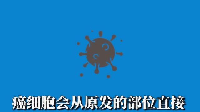 科普:癌细胞转移的“路”有4条,你都知道吗?