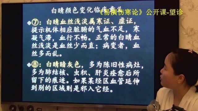 55中医望诊望眼睛睛白的分区及颜色临床意义易演伤寒论ⷦœ›诊公开课