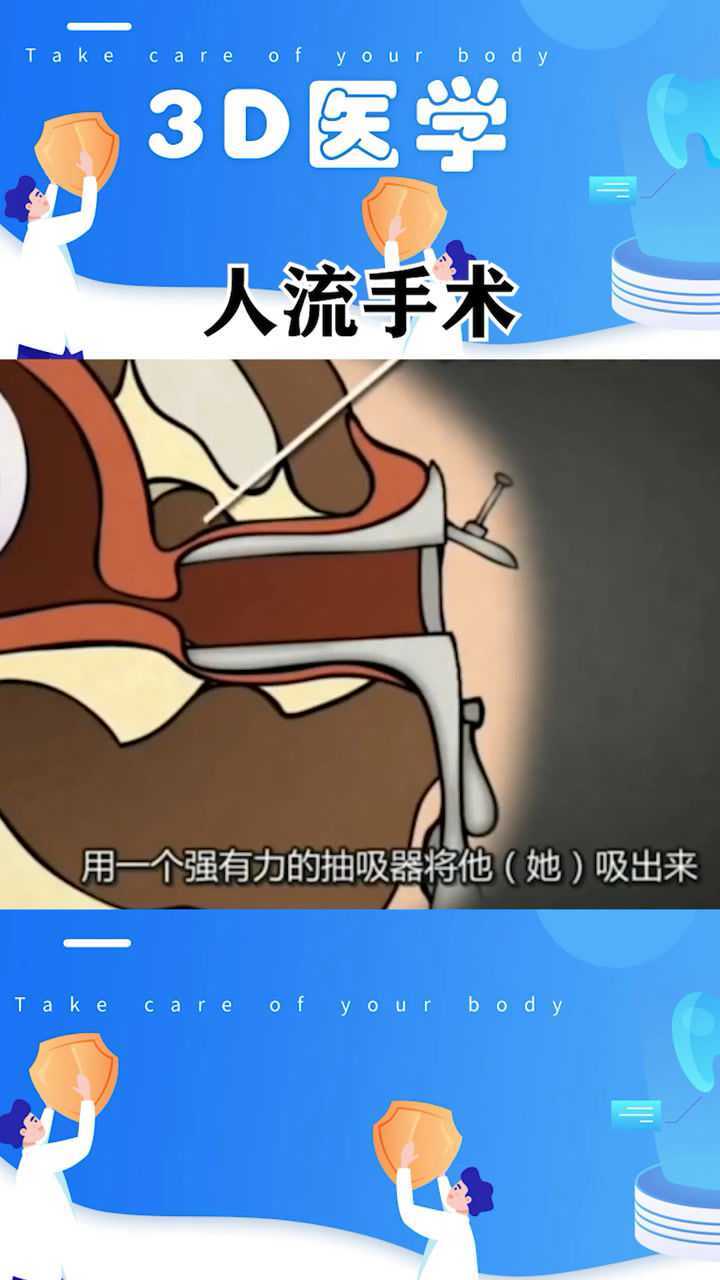 人流手术过程女生们好好爱护自己