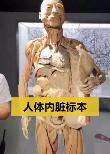 人体内脏标本1942年捐献的男性遗体经过塑造可以保存千年