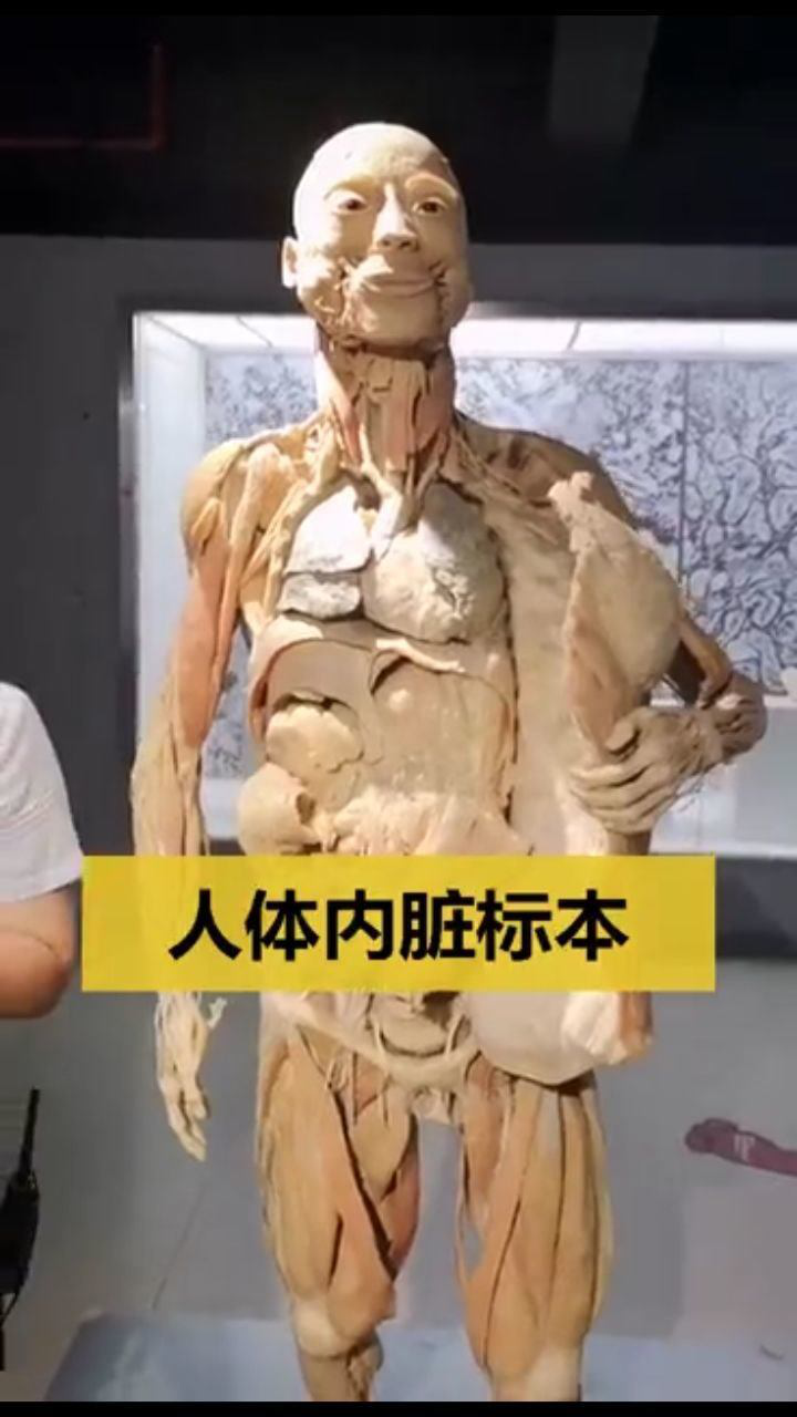 人体内脏标本1942年捐献的男性遗体经过塑造可以保存千年