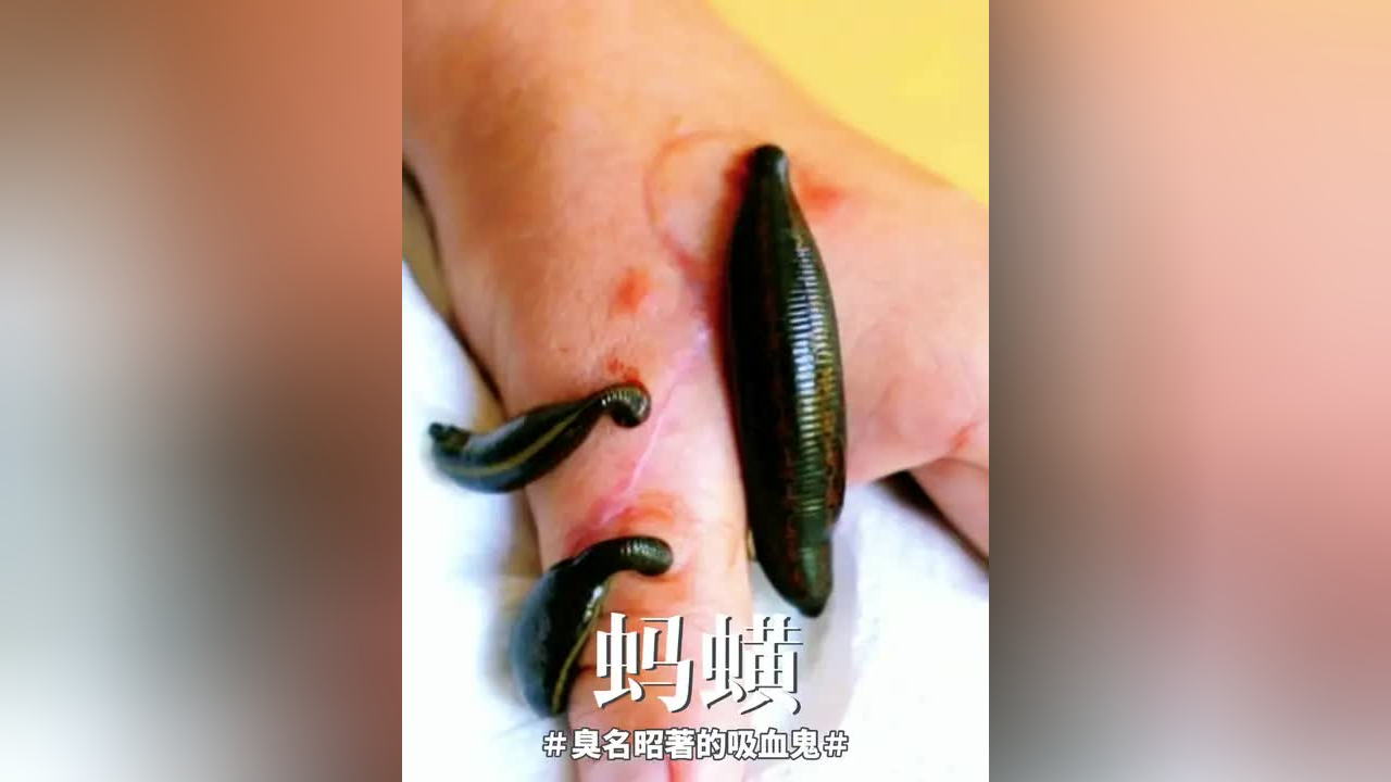 蚂蟥,自然界的吸血狂魔