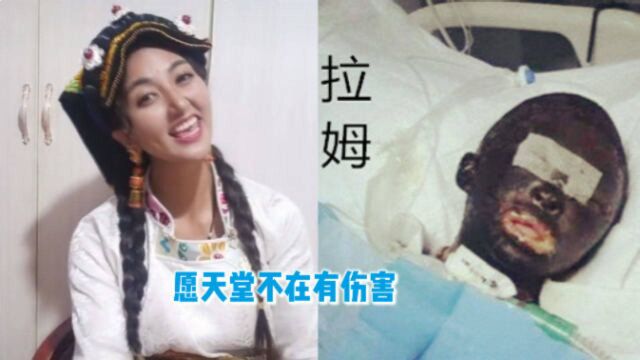 还是没扛过去!网红拉姆遭前夫纵火焚烧3小时后,入院治疗仍不幸离世