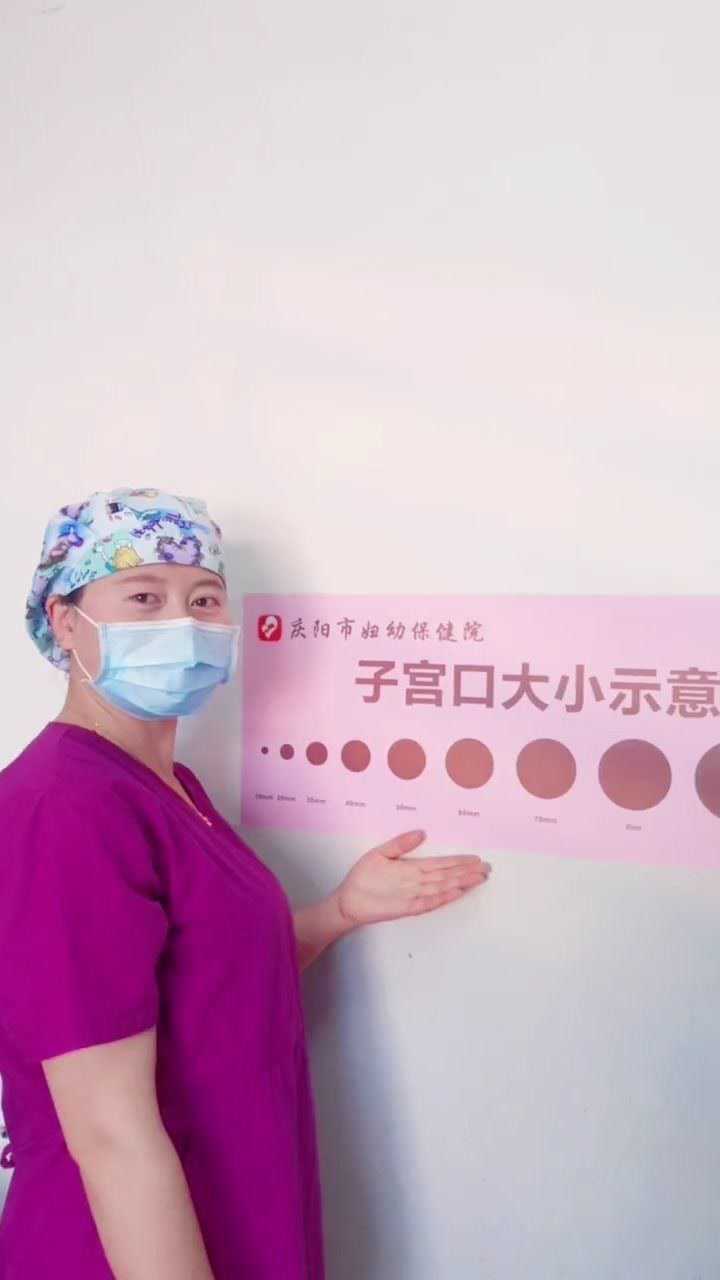子宫口大小示意图产科医护人员秒懂