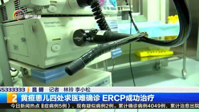 黄疸患儿四处求医难确诊 ERCP成功治疗