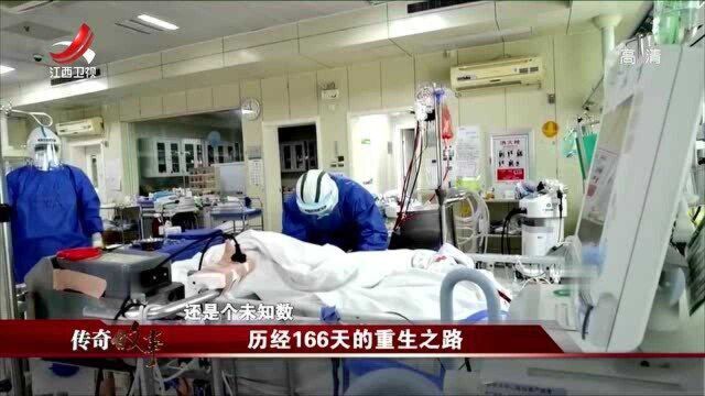 医生努力国家支持,经历166天时间,65岁男子活了过来