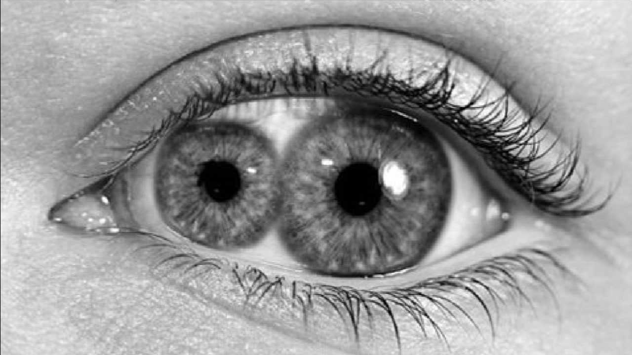 拥有双瞳孔的人,相比于其他人,眼睛有什么超能力?