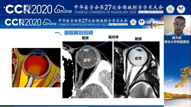眼眶急症(创伤)的影像学评估青岛大学附属医院郝大鹏