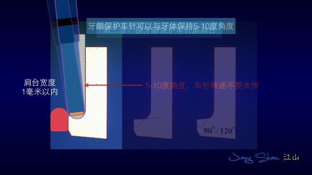 江山肩台车针 视频