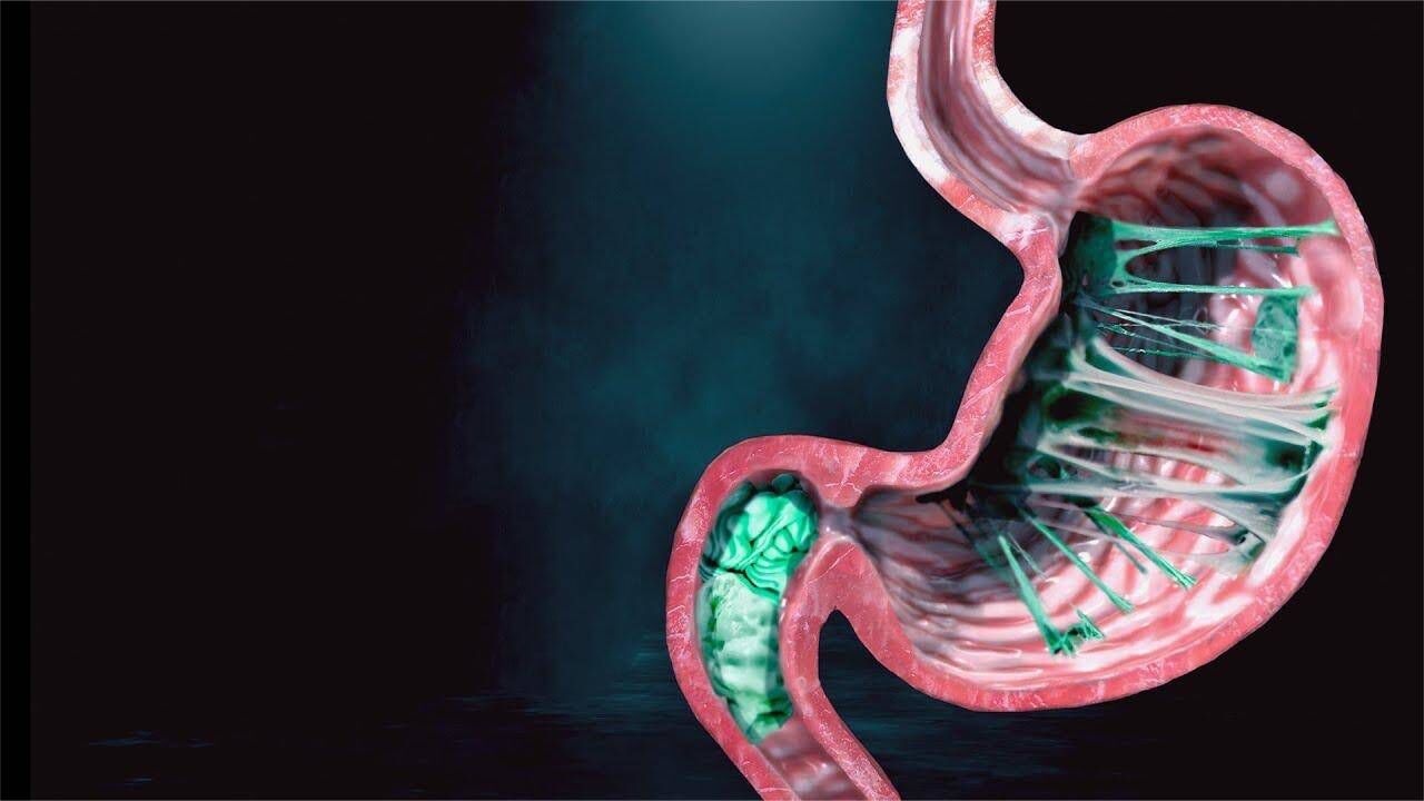 被吞进肚子里的口香糖,真的会在胃里停留7年吗?答案不可思议!