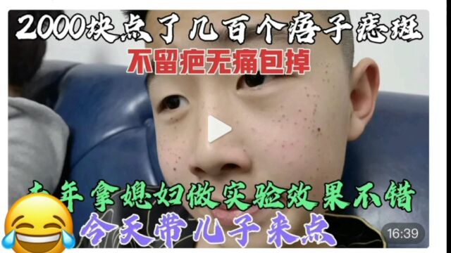 北京媳妇和儿子点痦子痣疣雀斑,前后点了300个,不留疤太美了!