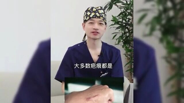 北京丽合医疗美容医院疤痕胎记:疤痕一直增生会是什么问题 