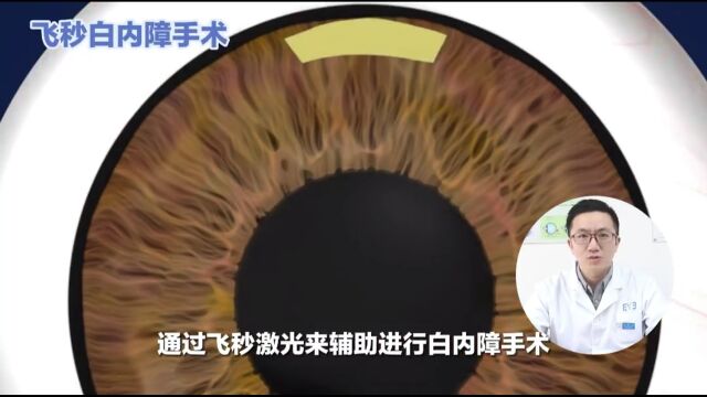 爱尔眼科医生带您1分钟了解飞秒激光白内障手术#长春爱尔眼科医院#