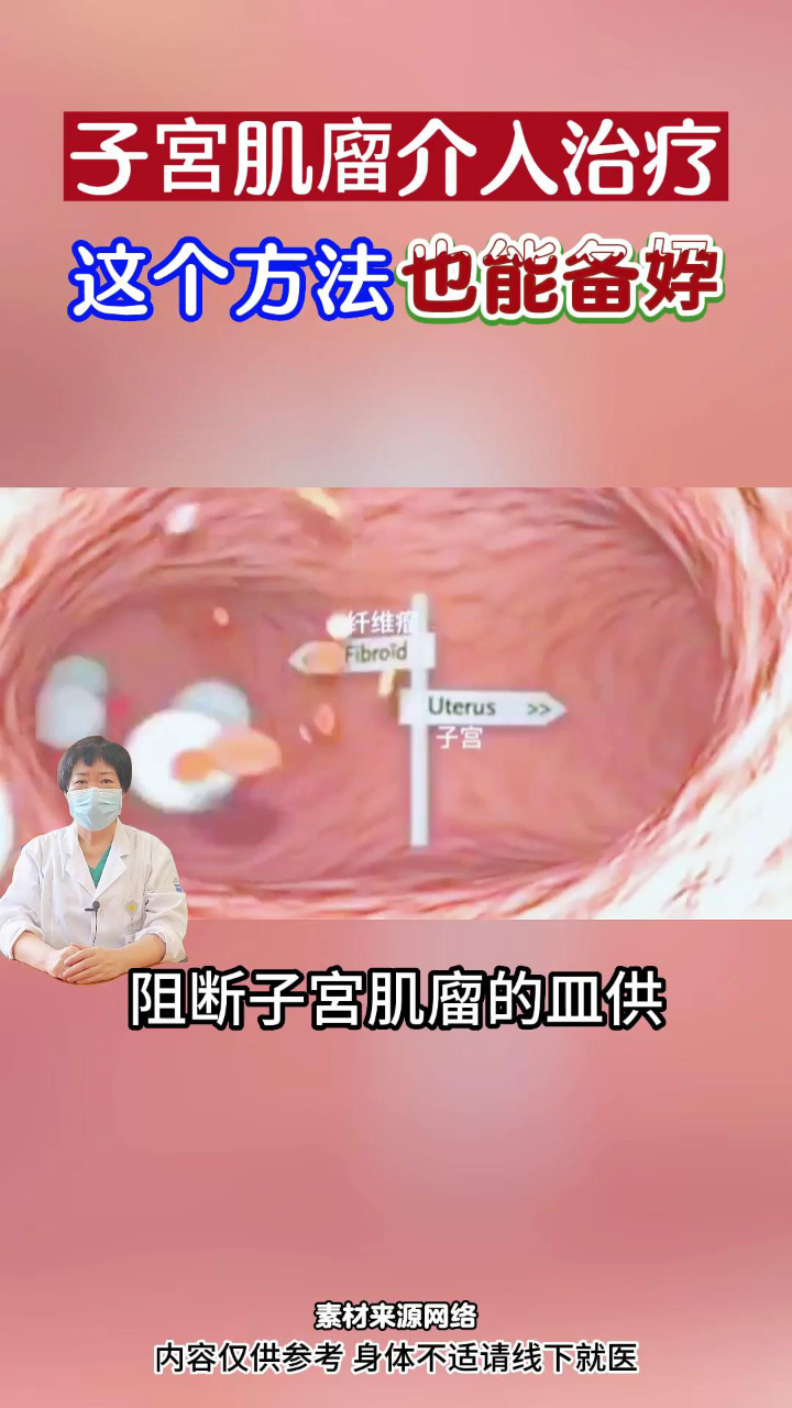 子宫肌瘤介入治疗是什么样的，一起来看看—温州不孕不育医院_高清